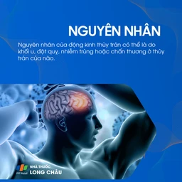 Động kinh thùy trán 3