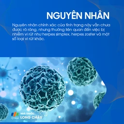 Liệt mặt ngoại biên 3