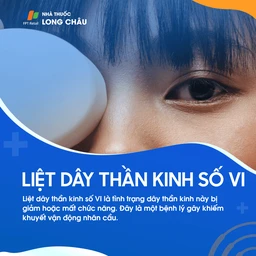 Liệt dây thần kinh số VI 1