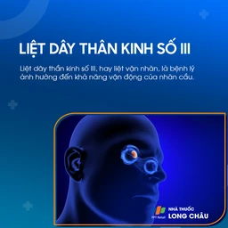 Liệt dây thần kinh số III 1