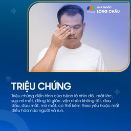 Liệt dây thần kinh số III 2