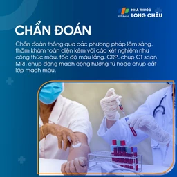 Liệt dây thần kinh số III 5