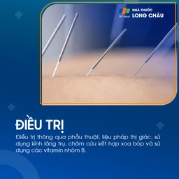 Liệt dây thần kinh số III 6