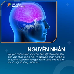 Liệt trên nhân tiến triển 3