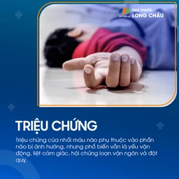 Đột quỵ não đang trải qua các triệu chứng như liệt nửa người và mất khả năng nói