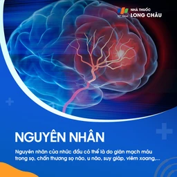 Căng thẳng, mất ngủ, thiếu nước, và các vấn đề về thị lực là những nguyên nhân 