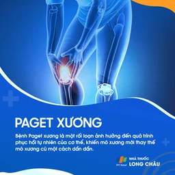 paget xương 1