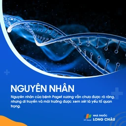 Paget xương 3