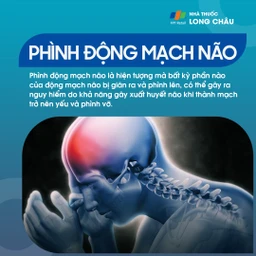 Phình động mạch não 1