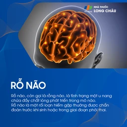 Rỗ não 1