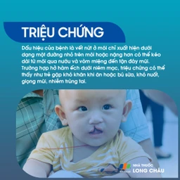 Sứt môi và hở hàm ếch 2