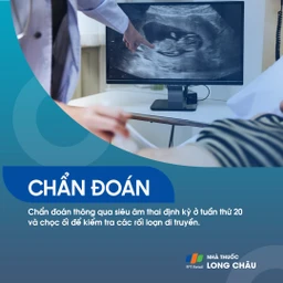 Sứt môi và hở hàm ếch 5
