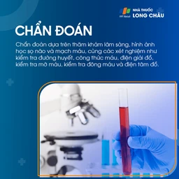 Cơn thiếu máu não cục bộ thoáng qua 5