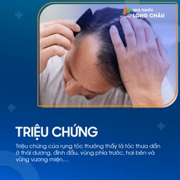 Tóc rụng 2