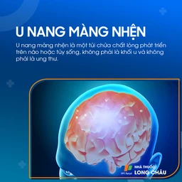 U nang màng nhện não 1
