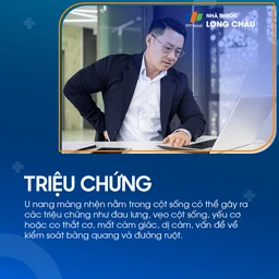 U nang màng nhện não 3