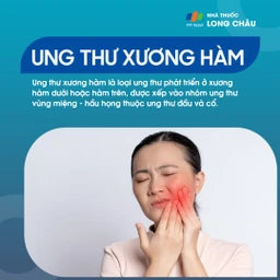 Ung thư xương hàm 1