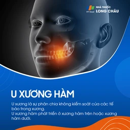 U xương hàm 1