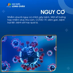 Viêm dây thần kinh tiền đình 4