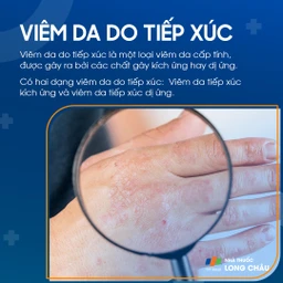 Viêm da do tiếp xúc 1