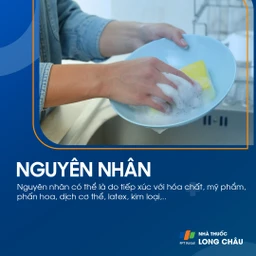 Nguyên nhân viêm da do tiếp xúc do hóa chất, mỹ phẩm và kim loại