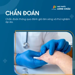 Chẩn đoán viêm da do tiếp xúc qua kiểm tra da liễu và xét nghiệm dị ứng