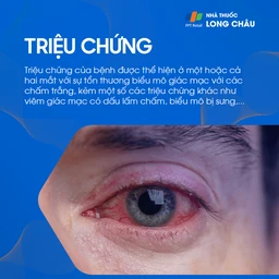 Viêm giác mạc chấm nông 2