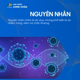 Viêm giác mạc chấm nông 3