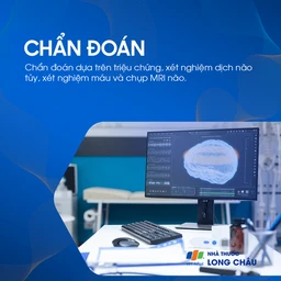Viêm não tự miễn 5