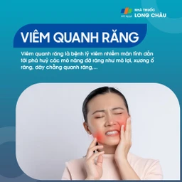 Viêm quanh răng 1