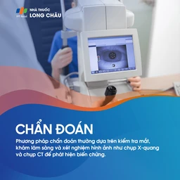 Viêm tổ chức hốc mắt 5