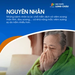 Viêm xương sọ 4