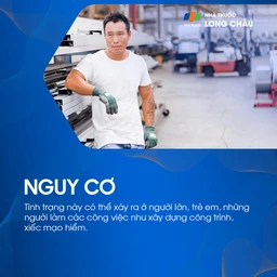 Vỡ xương hốc mắt 4