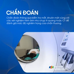 Vỡ xương hốc mắt 5
