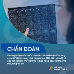 Xuất huyết dưới nhện 5
