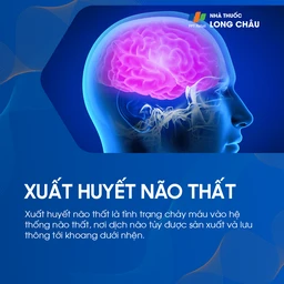 Xuất huyết não thất 1
