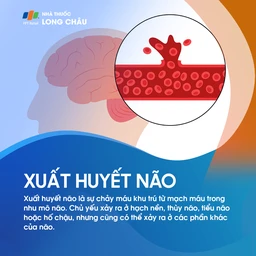 Xuất huyết não 1