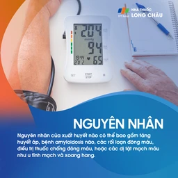 Xuất huyết não 3