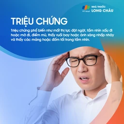 Xuất huyết võng mạc 2