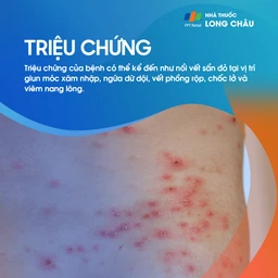 Ấu trùng da di chuyển 2