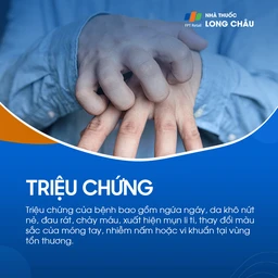 Triệu chứng gồm ngứa ngáy, da khô nứt nẻ, đau rát, chảy máu, mụn li ti, thay đổi màu móng, nhiễm nấm
