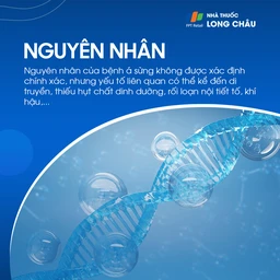 Nguyên nhân chưa xác định rõ, liên quan đến di truyền, thiếu dinh dưỡng, rối loạn nội tiết tố và khí hậu