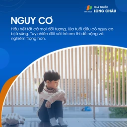 Mọi lứa tuổi đều có nguy cơ bị á sừng, trẻ em dễ bị nặng