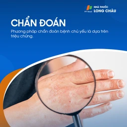 Chẩn đoán á sừng chủ yếu dựa trên triệu chứng lâm sàng