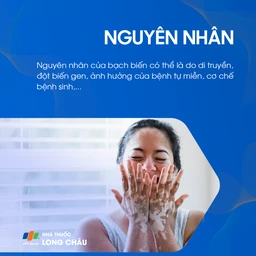 Nguyên nhân bạch biến có thể liên quan đến di truyền, đột biến gen hoặc bệnh tự miễn