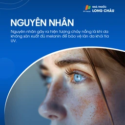 Nguyên nhân cháy nắng thường gặp nhất là do không sử dụng kem chống nắng