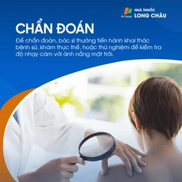 Chẩn đoán cháy nắng dựa trên dấu hiệu bên ngoài của da và mức độ tổn thương