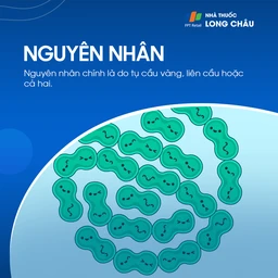 Do vi khuẩn tụ cầu vàng, liên cầu, hoặc cả hai gây ra