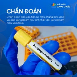 Da bọng nước tự miễn Pemphigus 5