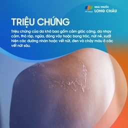 Da căng, thô ráp, ngứa, bong tróc, nứt nẻ, có thể chảy máu ở vết nứt sâu